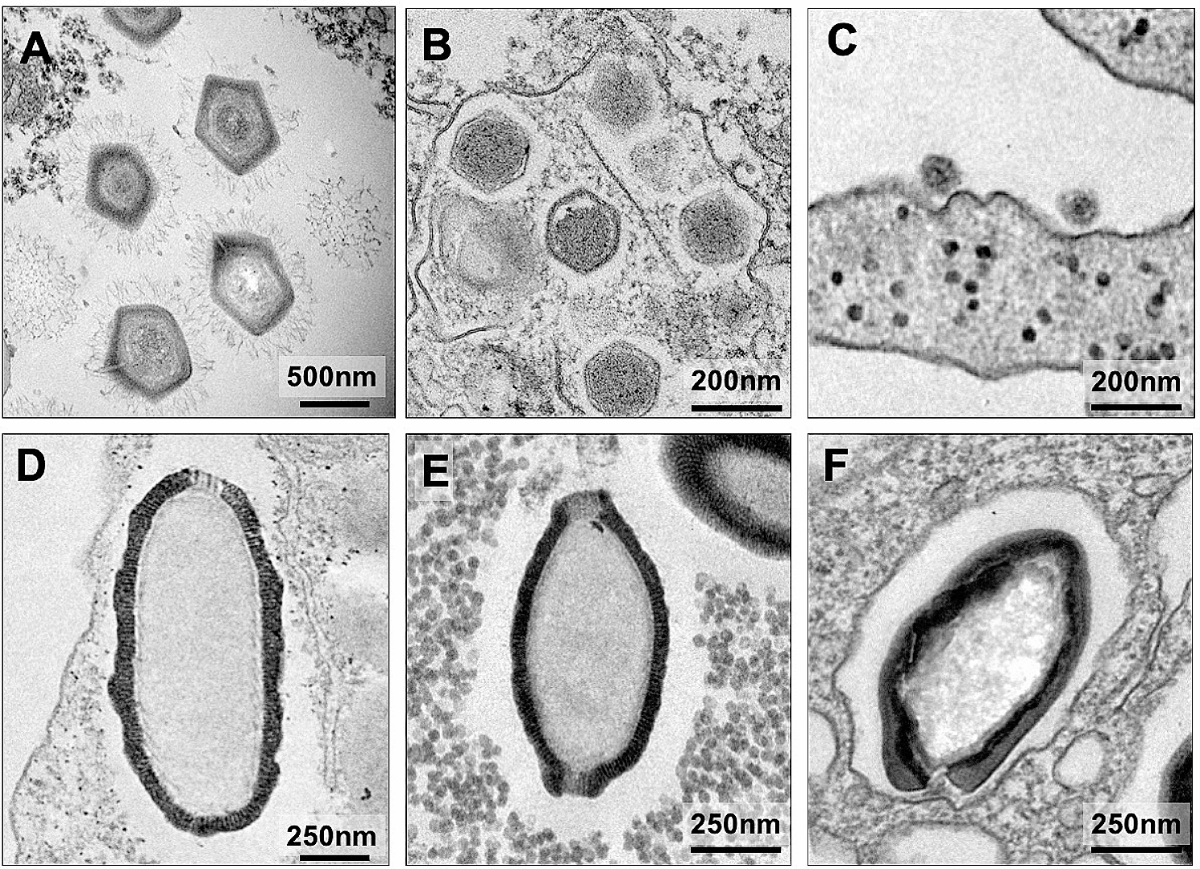 Son de un tamaño tenebroso, la verdad. Son de un tamaño tenebroso, la verdad.