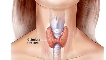 Cáncer de tiroides en una jornada para concientizar. Cáncer de tiroides en una jornada para concientizar.