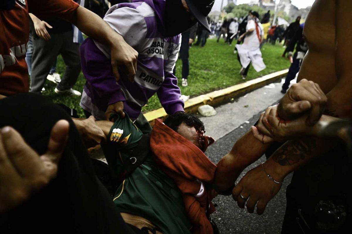 El fotógrafo Pablo Grillo, herido durante una marcha de jubilados por fuerzas federales a cargo de Patricia Bullrich. El fotógrafo Pablo Grillo, herido durante una marcha de jubilados por fuerzas federales a cargo de Patricia Bullrich.