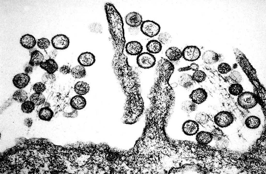 Virus de Hanta o Hantavirus Virus de Hanta o Hantavirus