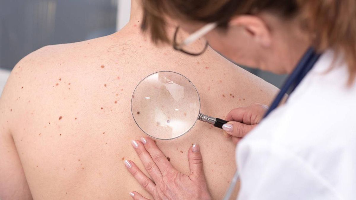 Cáncer de piel: La Universidad de Stanford descubre cómo hacer transparente el tejido vivo