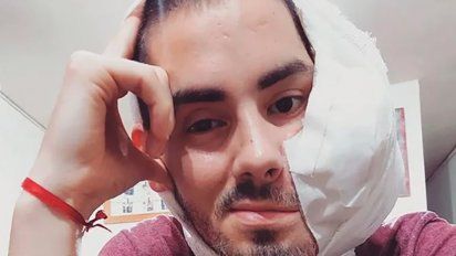 Murió Sebastián Amurín, el joven con un tumor en el rostro