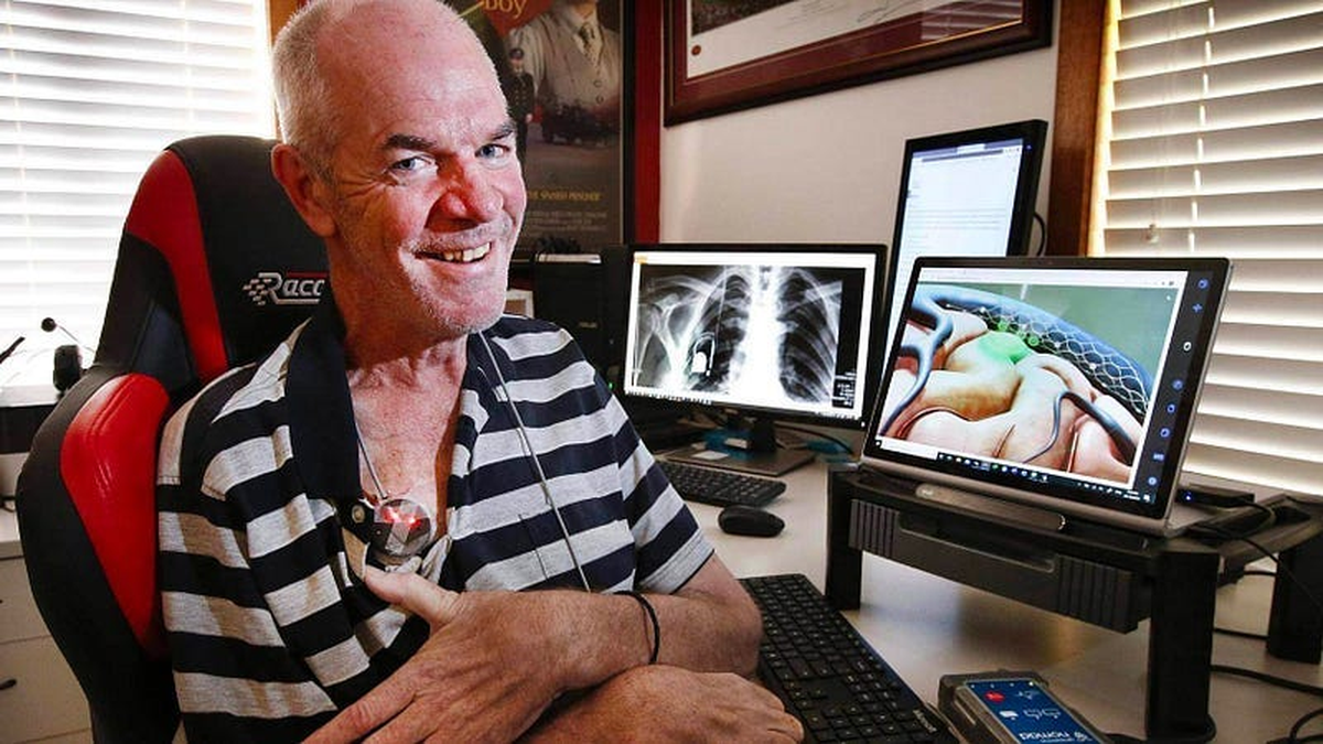 Los beneficiarios del BCI han podido comer, beber, enviar correos electrónicos y operar brazos robóticos con solo pensar. Algunos incluso pudieron recuperar el sentido del tacto y otros el movimiento de extremidades. Los beneficiarios del BCI han podido comer, beber, enviar correos electrónicos y operar brazos robóticos con solo pensar. Algunos incluso pudieron recuperar el sentido del tacto y otros el movimiento de extremidades.