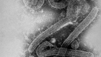 Virus de Marburgo Virus de Marburgo