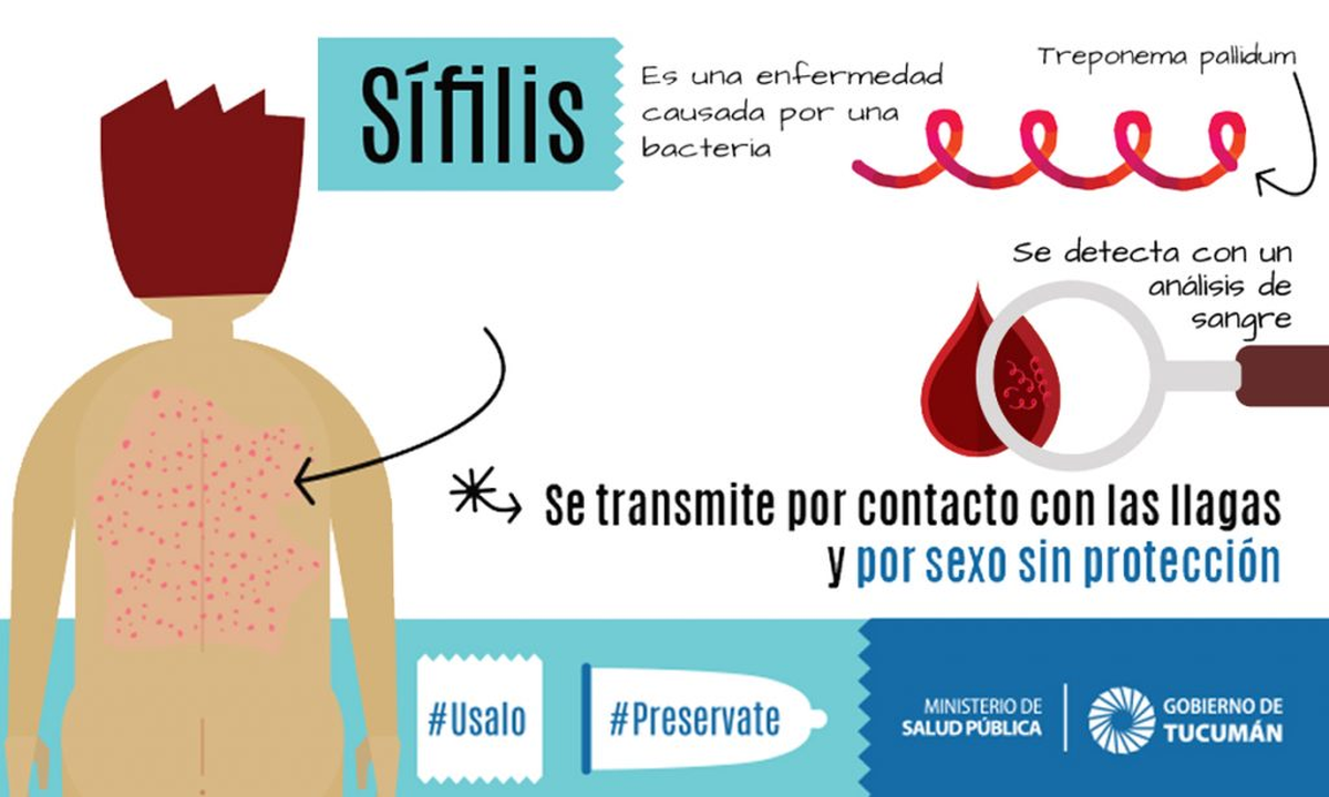 Las provincias hacen campañas sobre el riesgo de la sífilis. La Nación, no. Las provincias hacen campañas sobre el riesgo de la sífilis. La Nación, no.