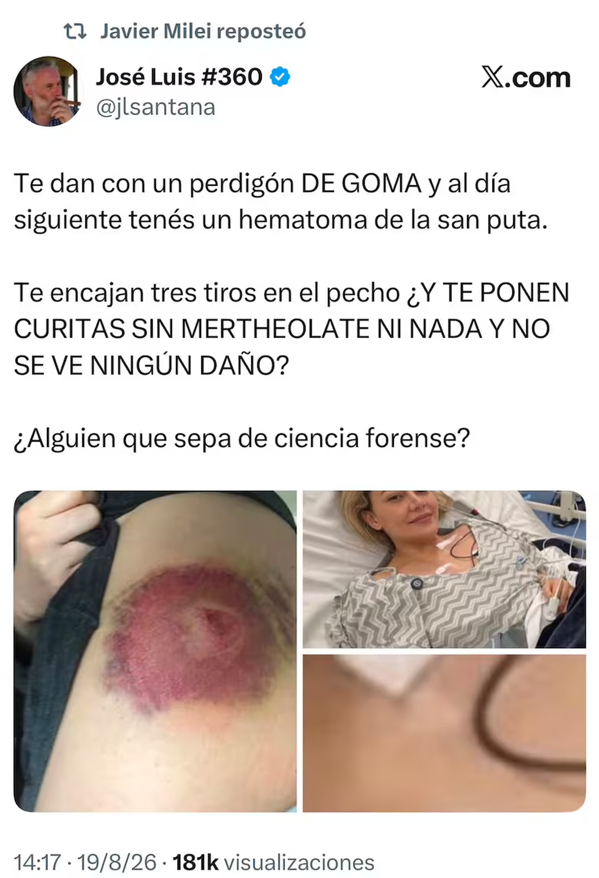 Mientras la Justicia boliviana investiga el ataque contra Nadie Baller, Javier Milei y varios referentes libertarios cuestionaron el atentado y sus heridas. Foto: X Mientras la Justicia boliviana investiga el ataque contra Nadie Baller, Javier Milei y varios referentes libertarios cuestionaron el atentado y sus heridas. Foto: X