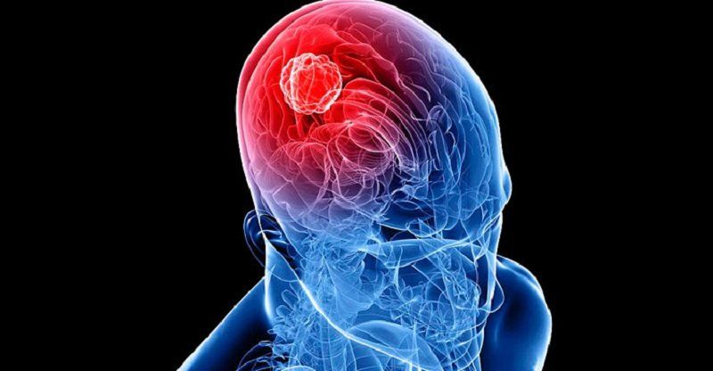 Tumor cerebral