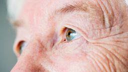 Alimentos que necesitas para prevenir cataratas en los ojos. Alimentos que necesitas para prevenir cataratas en los ojos.