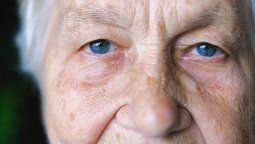 Alzheimer: Los síntomas pueden incluir dificultades en la vista.