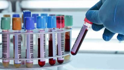 Pacientes de prepagas y obras sociales se quedarán sin laboratorios