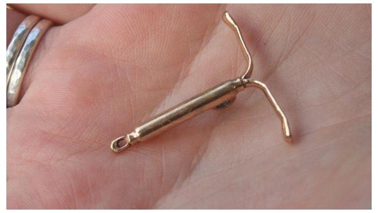 El acceso a los anticonceptivos sigue siendo un desafío en los países en vías de desarrollo