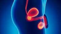 Cómo es el tratamiento contra el cáncer de próstata que incopora la medicina nuclear. Cómo es el tratamiento contra el cáncer de próstata que incopora la medicina nuclear.