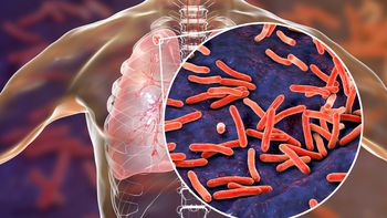 La tuberculosis es la decimotercera causa principal de muerte en todo el mundo. La tuberculosis es la decimotercera causa principal de muerte en todo el mundo.