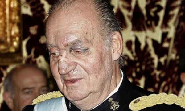 Rey Juan Carlos I de Borbón, convaleciente.