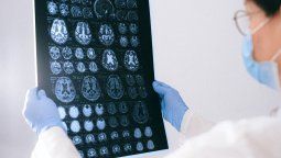 Esta bebida es peor para el cerebro de lo que se cree.