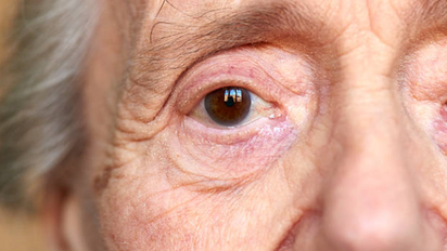 El síntoma de Alzheimer que podría manifestarse al vestirse