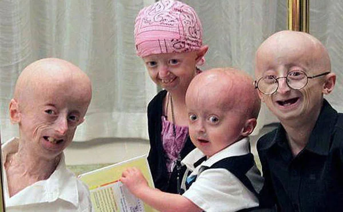 Las enfermedades raras o poco frecuentes afectan a muy pocas personas alrededor del mundo y existen entre 7.000 y 8.000 identificadas. Las enfermedades raras o poco frecuentes afectan a muy pocas personas alrededor del mundo y existen entre 7.000 y 8.000 identificadas.