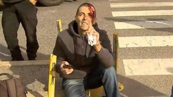 el fiscal delgado permanecera en observacion tras ser atropellado el fiscal delgado permanecera en observacion tras ser atropellado