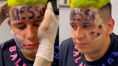 Des-influencers: Se tatuó Messi en la frente y se arrepintió