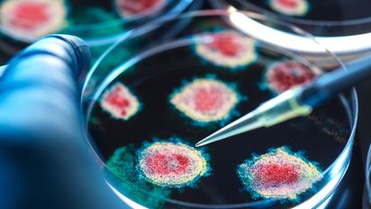 ¿Nuevo Covid? Este virus mortal en USA podría ser mucho peor