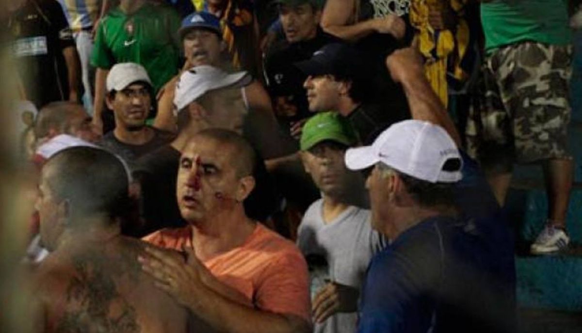 Andrés Bracamonte.en una ocasión que le metieron 3 balas de goma en el rostro.