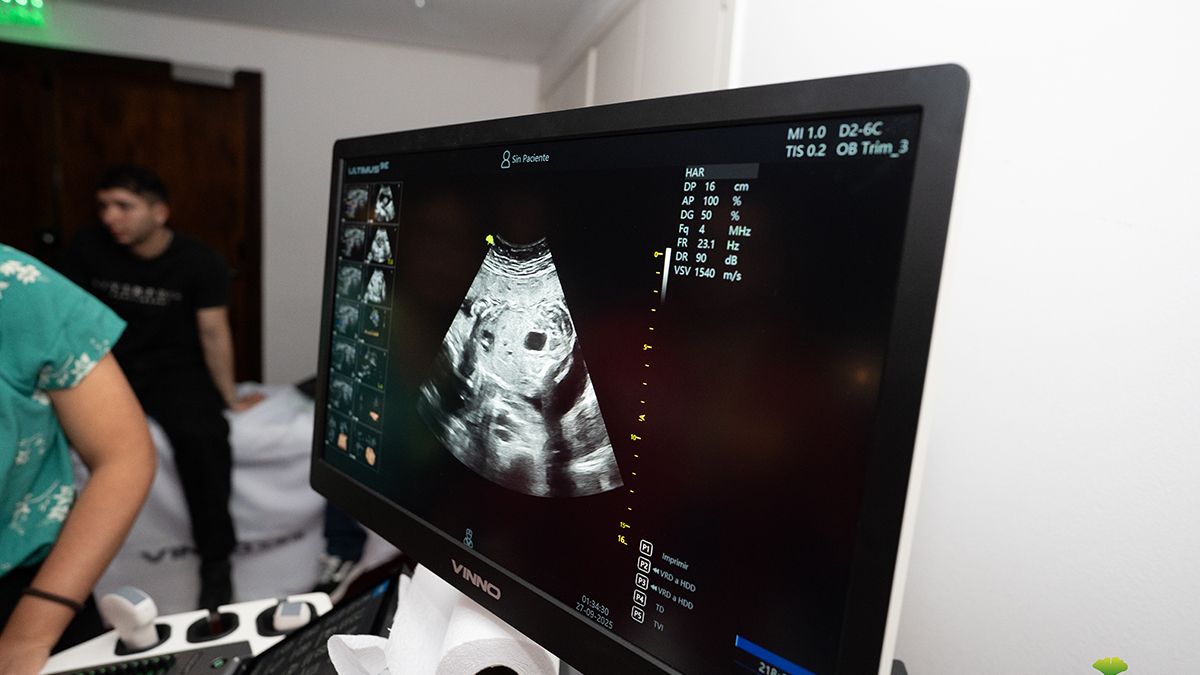 La empresa CSH (Centro de Servicios Hospitalarios) en Argentina continúa con su innovación en diagnóstico por imágenes con la tecnología en ultrasonido. La empresa CSH (Centro de Servicios Hospitalarios) en Argentina continúa con su innovación en diagnóstico por imágenes con la tecnología en ultrasonido.