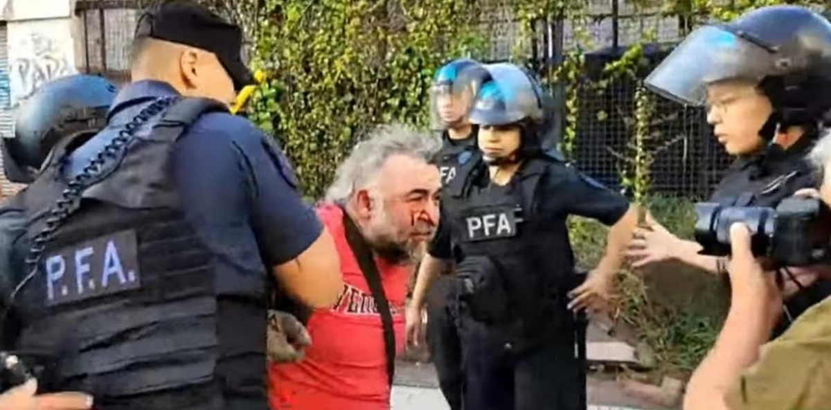 Tensión en las afueras del Congreso: violencia y ataque contra periodistas. Un camarógrafo herido. Tensión en las afueras del Congreso: violencia y ataque contra periodistas. Un camarógrafo herido. 